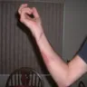 Sonic Drive-In - burns - Photo 1
