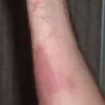 Sonic Drive-In - burns - Photo 2