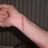 Sonic Drive-In - burns - Photo 3