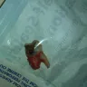 Western Dental Services - quoted and pressured for unneccessary work - Photo 1