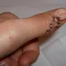 Cuisinart - 8 stitches to left hand - Photo 1