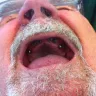 Smile Implant Center / California Implant Smiles - unskilled employee, material used and hacks - Photo 1