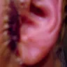 Lifestyle Lift - Resulting problems - Photo 1