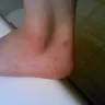 Dakota Canyon Apartments - failure to listen to complaints and provide solutions - Photo 3