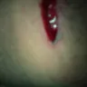 Aflac - not covering on accident - Photo 3