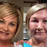 Arbonne - severe skin reaction - Photo 1