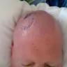SAMER GHOSTINE MD - UNNECESSARY SURGERY - Photo 2