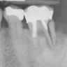 Fred E Zietz DDS - Unethical advertising - Photo 1