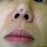 Kalo plastic surgery - Dont go KALO to do any plastic surgery - Photo 1