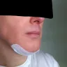 Dr David Ross - OFF-CENTRE CHIN IMPLAN