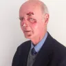 LastMinute.com - Lastminute.com fail to give refund after brain injury - Photo 1