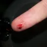 Office Depot - office chair causes bleeding injuries/ one star reviews deleted - Photo 1