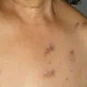 Rug Doctor - Bed Bugs - Photo 3