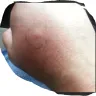 Red Roof Inn - bed bugs!!! - Photo 1