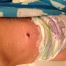 Huggies - overnites - Photo 1