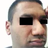 Dr. Anil R. Shah, MD - Rhinoplasty - Photo 2