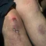 Ster-Kinekor - poor lighting leads to painful fall, management unhelpful - Photo 2