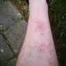 Ster-Kinekor - poor lighting leads to painful fall, management unhelpful - Photo 3