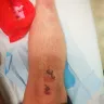 Ster-Kinekor - poor lighting leads to painful fall, management unhelpful - Photo 5