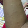 Andhra Pradesh State Road Transport Corporation [APSRTC] - bed bugs in apsrtc bus service no 48605 - Photo 1