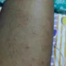 Andhra Pradesh State Road Transport Corporation [APSRTC] - bed bugs in apsrtc bus service no 48605 - Photo 2