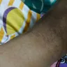 Andhra Pradesh State Road Transport Corporation [APSRTC] - bed bugs in apsrtc bus service no 48605 - Photo 3