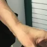 Whataburger - injury caused by your employee - Photo 1