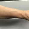 Whataburger - injury caused by your employee - Photo 7