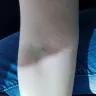 BioLife Plasma Services - tiny little scratches on my arm - ankeny iowa