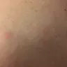 Best Western International - service and bed bugs! - Photo 4