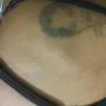 Hotels.com - bites from bed bugs - Photo 4
