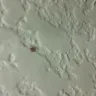 Hotels.com - bites from bed bugs - Photo 6
