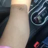 American Red Cross - negligence with inexperienced phlebotomist - Photo 1