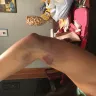 American Red Cross - negligence with inexperienced phlebotomist - Photo 4