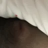 RIU Hotels & Resorts - unsafe condition and terrible customer service - Photo 1