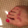 Coach - coach new york loafer shoes-damage to foreskin and severe burns - Photo 1