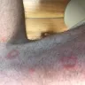 Motel 6 - I woke up and have some type of bites all over my arms and legs - Photo 2