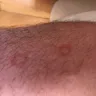 Motel 6 - I woke up and have some type of bites all over my arms and legs - Photo 3