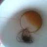 Tim Hortons - yuky group of head hair inside the cup of coffee - Photo 1