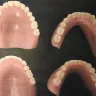 Aspen Dental - dentures
