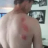 Motel 6 - bugs and flees ate me alive - Photo 1