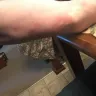 Days Inn - bed bugs - Photo 2
