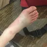 RIU Hotels & Resorts - boyfriend injured/no compensation - Photo 4