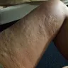 Motel 6 - bed bugs - Photo 5