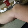 Motel 6 - bed bugs - Photo 8