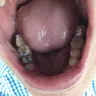 Aspen Dental - quality of work - Photo 1