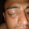 Motel 6 - woke up with pink eye - Photo 1