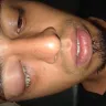Motel 6 - woke up with pink eye - Photo 3