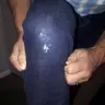 Levi Strauss & Co. - product defect - Photo 2