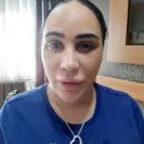 Revitalize in Turkey - Rhinoplasty - Photo 1 - comment #2154453